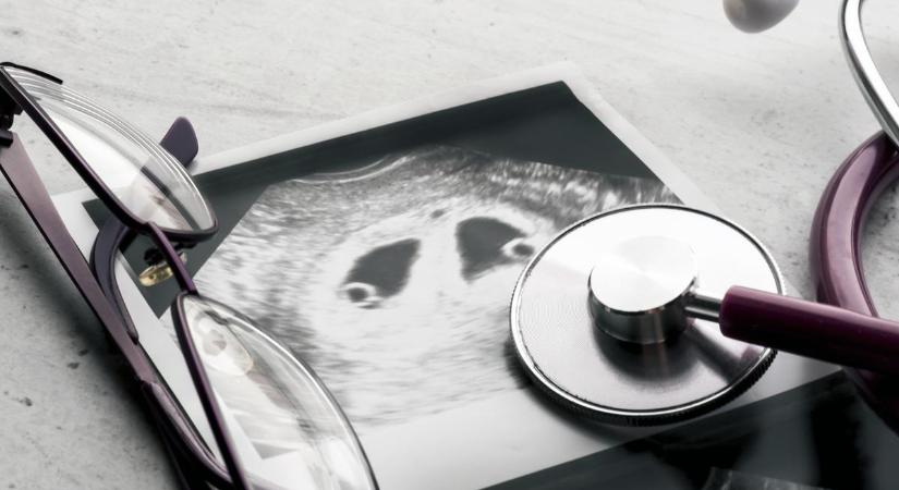 Egy sima ultrahang vizsgálatra mentek, alig kaptak levegőt, amikor meglátták mit csinálnak az anyaméhben az ikrek